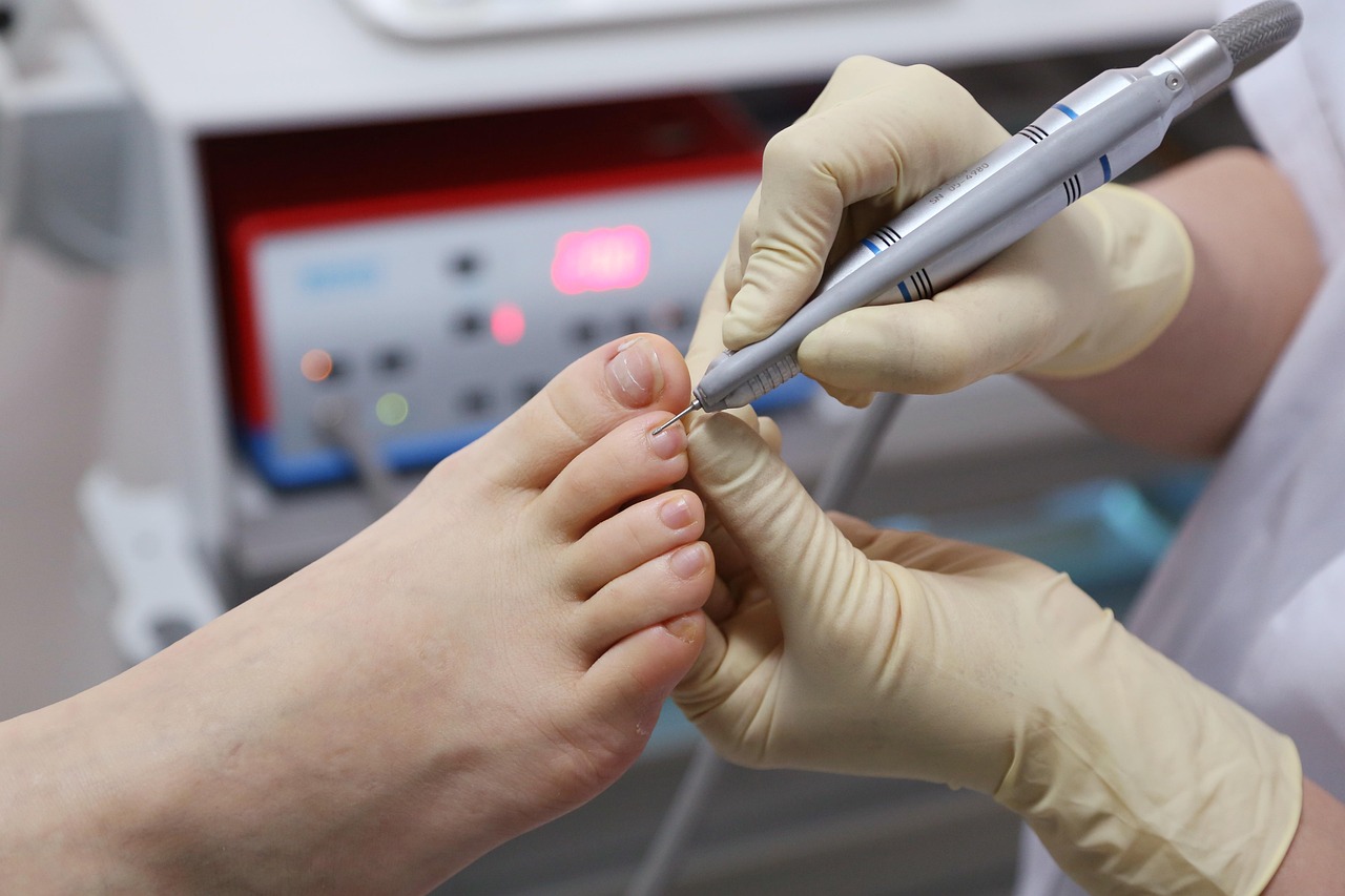 toenails-6157935_1280
